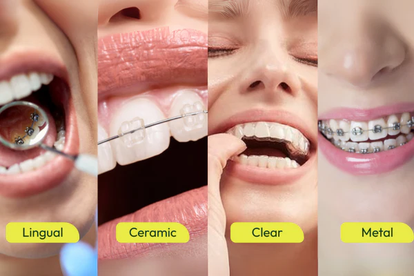 The Ultimate Guide to Family Dental Health